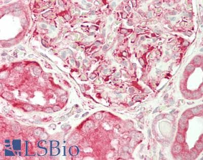 IHC-plus™ Polyclonal Rabbit anti-Human SDCCAG3 Antibody (aa218-435, IHC, WB)