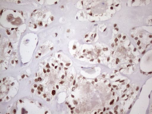 TP53BP1 / 53BP1 Antibody (aa1-300, clone OTI2H6)