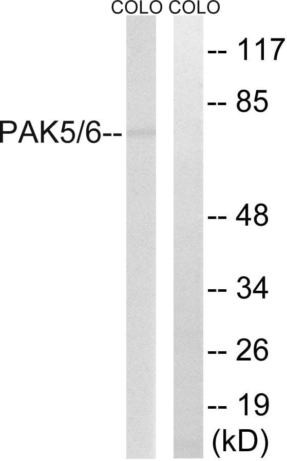 PAK5 + PAK6 Antibody (p602/560)