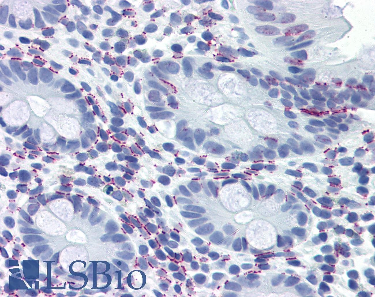 IHC-plus™ Vitamin D Receptor / VDR Antibody (aa89-105)