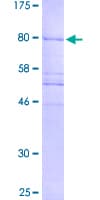 Human Translokin / CEP57 Protein (Recombinant GST)