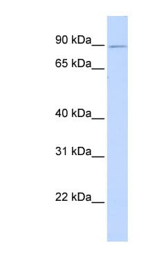 ZNF408 / PRDM17 Antibody (aa396-445)