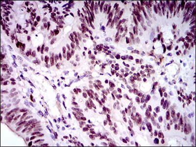 FOXP1 Antibody (clone 6E4)