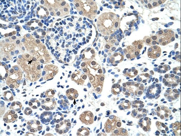 COUP-TFII / NR2F2 Antibody (aa141-190, FITC)