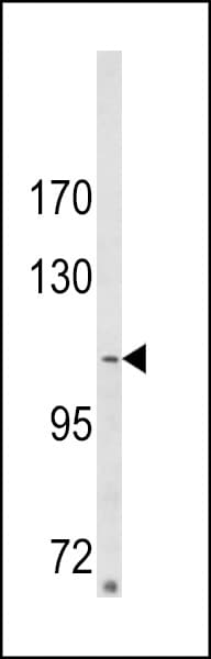 SORBS2 / ARGBP2 Antibody (aa175-204)