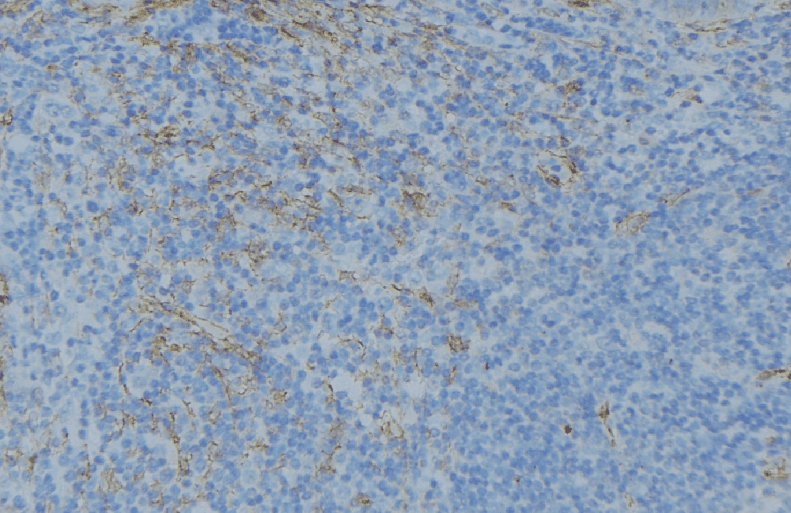 GSTT1 Antibody