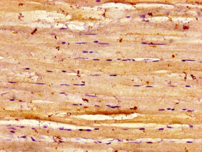 Dysferlin Antibody (aa105-278)