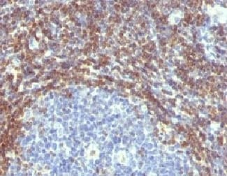 BCL2 / Bcl-2 Antibody (clone ARBC2-1, Ready-to-Use)