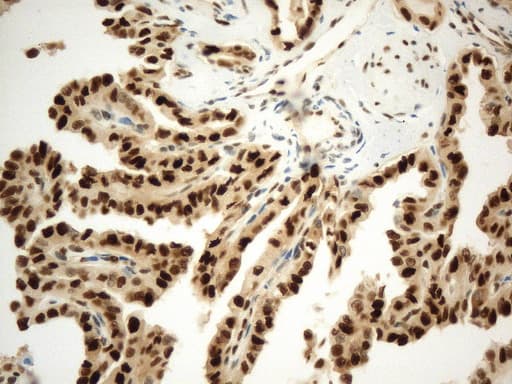 PCNA Antibody (clone UMAB278)