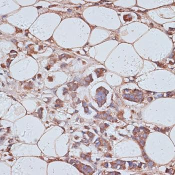 TAX1BP1 Antibody