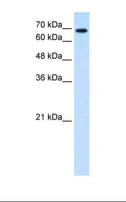 Polyclonal Rabbit anti-Human RPN2 / Ribophorin II Antibody (aa140-189, IHC, WB)