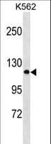 Polyclonal Rabbit anti-Human PCDHA2 Antibody (aa253-282, WB)