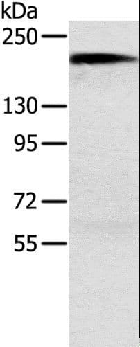 ACE / CD143 Antibody