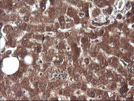 CTAG1B / NY-ESO-1 Antibody (clone OTI5B2)