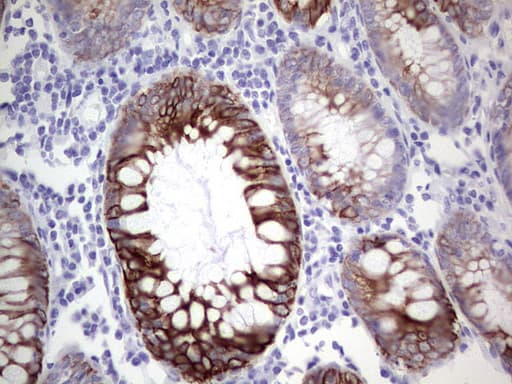 Monoclonal Mouse anti-Human KRT19 / CK19 / Cytokeratin 19 Antibody (clone OTI5F4, aa240-390, IHC, WB)