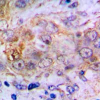 Polyclonal Rabbit anti-Human CA2 / Carbonic Anhydrase II Antibody (C-Terminus, IHC, WB)