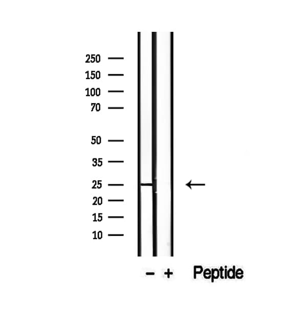 RAB3A Antibody (aa1-20)