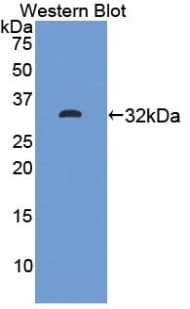EPCAM Antibody (aa25-265)