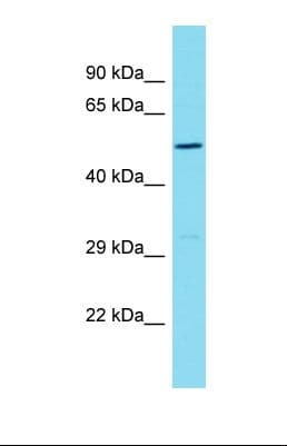 PIH1D2 Antibody (aa61-110)