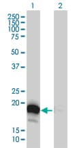 IHC-plus™ DUT / DUTPase Antibody (clone 1C9)