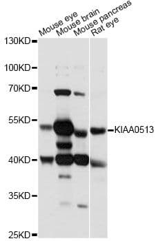 Polyclonal Rabbit anti-Human KIAA0513 Antibody (WB)