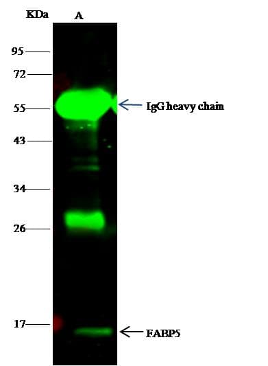 Polyclonal Rabbit anti-Human E-FABP / FABP5 Antibody (Preservative Free, IF, WB)