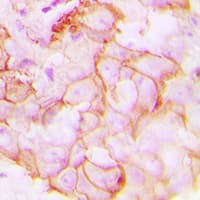 Polyclonal Rabbit anti-Human GPR20 Antibody (C-Terminus, IHC, WB)