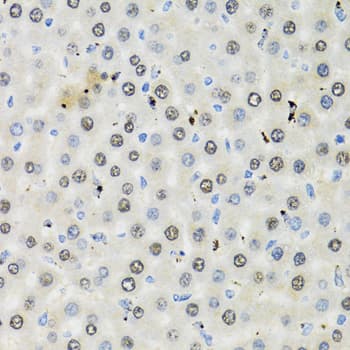 CDK6 Antibody