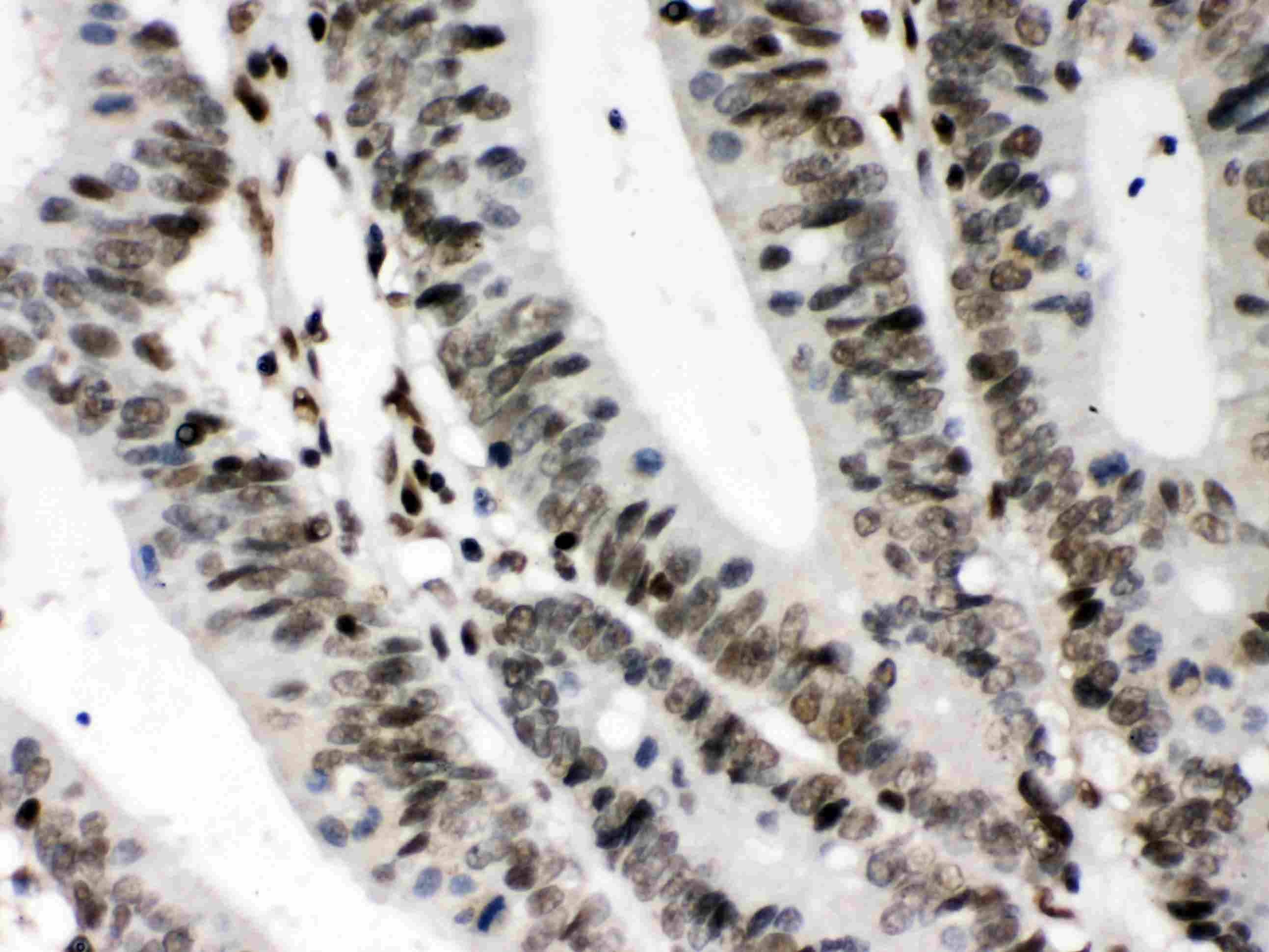 CIITA Antibody