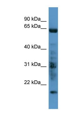 Polyclonal Rabbit anti-Human GRK7 / GPRK7 Antibody (C-Terminus, WB)