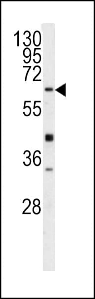 GGTLA1 / GGT5 Antibody (aa130-156)
