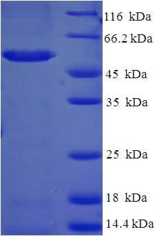Human BABP / AKR1C2 Protein (Recombinant His-SUMO)
