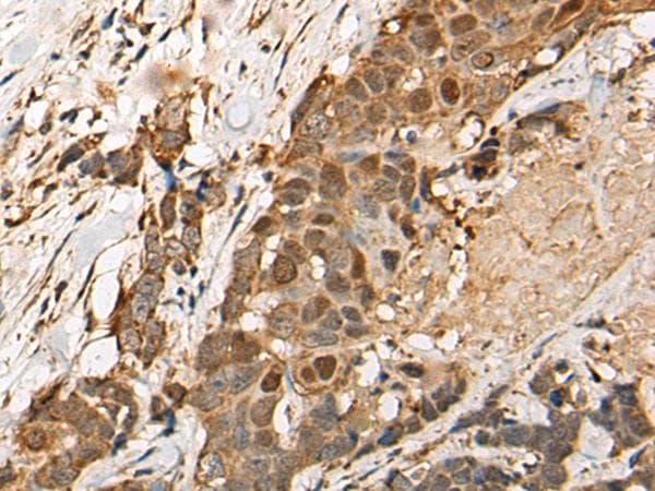 Polyclonal Rabbit anti-Human HEATR9 Antibody (IHC)