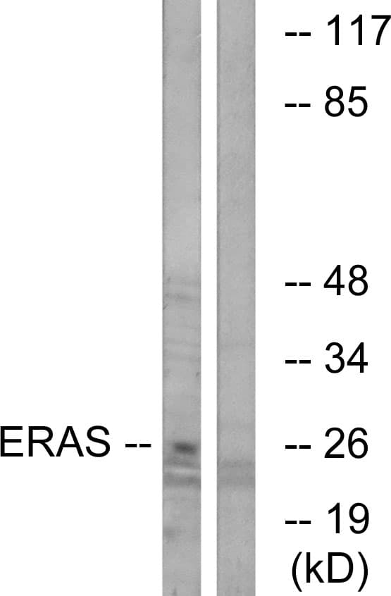 Polyclonal Rabbit anti-Human ERAS Antibody (aa184-233, IF, WB)