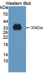 CYBB / NOX2 / gp91phox Antibody (aa283-570, FITC)