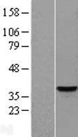 Human SLC25A42 Protein (Over-Expression Lysate Myc-DDK (Flag))