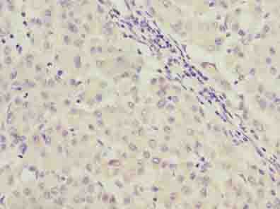 Polyclonal Rabbit anti-Human C9orf64 Antibody (IHC, WB)