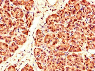 Polyclonal Rabbit anti-Human PRDM4 Antibody