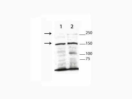 TET3 Antibody (aa1-160)