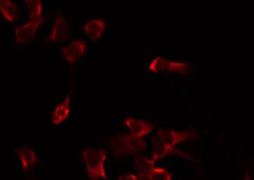 PHYKPL / AGXT2L2 Antibody