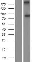 Human ODF2 Protein (Over-Expression Lysate Myc-DDK (Flag))
