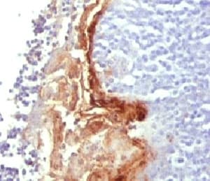 IVL / Involucrin Antibody (clone SY5, Ready-to-Use)