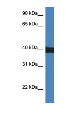 MAPK9 / JNK2 Antibody (aa40-89)