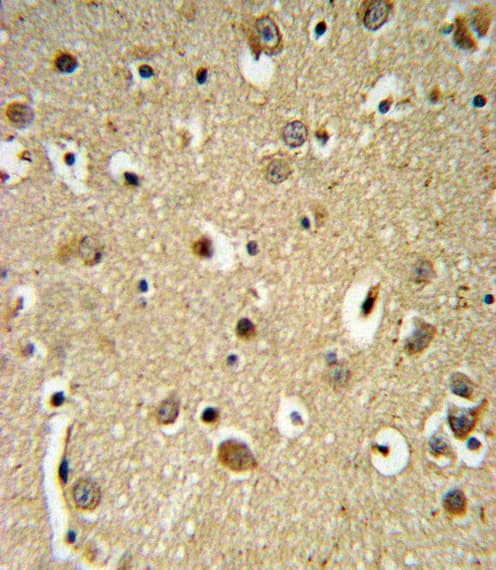 Sprouty 4 / SPRY4 Antibody (aa26-56)