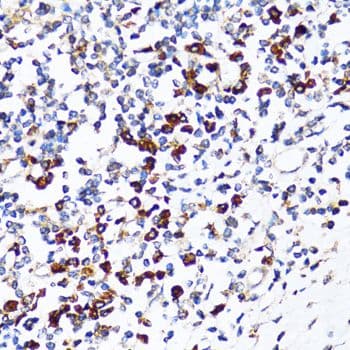 RPN1 / Ribophorin I Antibody