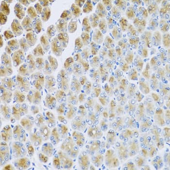 Polyclonal Rabbit anti-Human AP1M2 Antibody (IHC, WB)