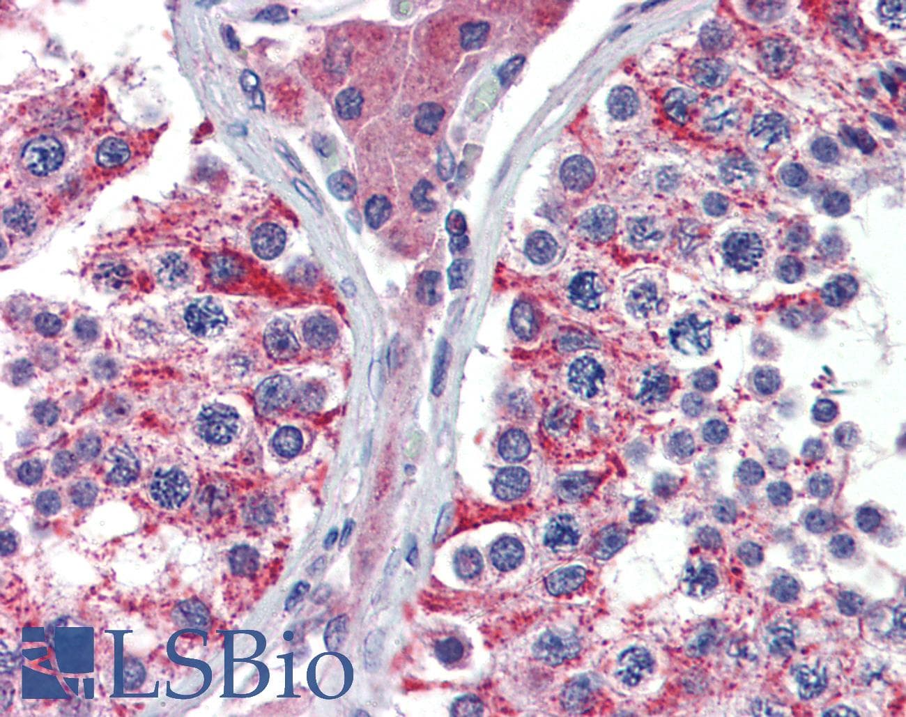 IHC-plus™ AIFM1 / AIF / PDCD8 Antibody