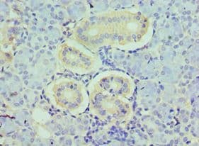 HDAC8 Antibody (aa1-377)