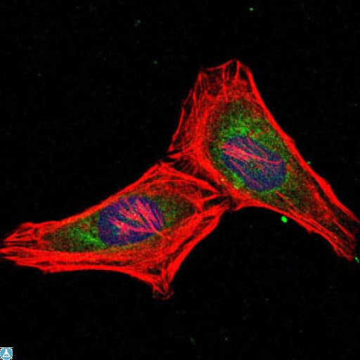 PSMB8 / LMP7 Antibody