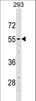 Polyclonal Rabbit anti-Human NT5DC2 Antibody (aa289-317, WB)